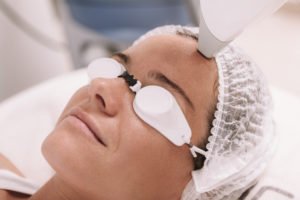 Read more about the article Facial hair reduction through laser therapy