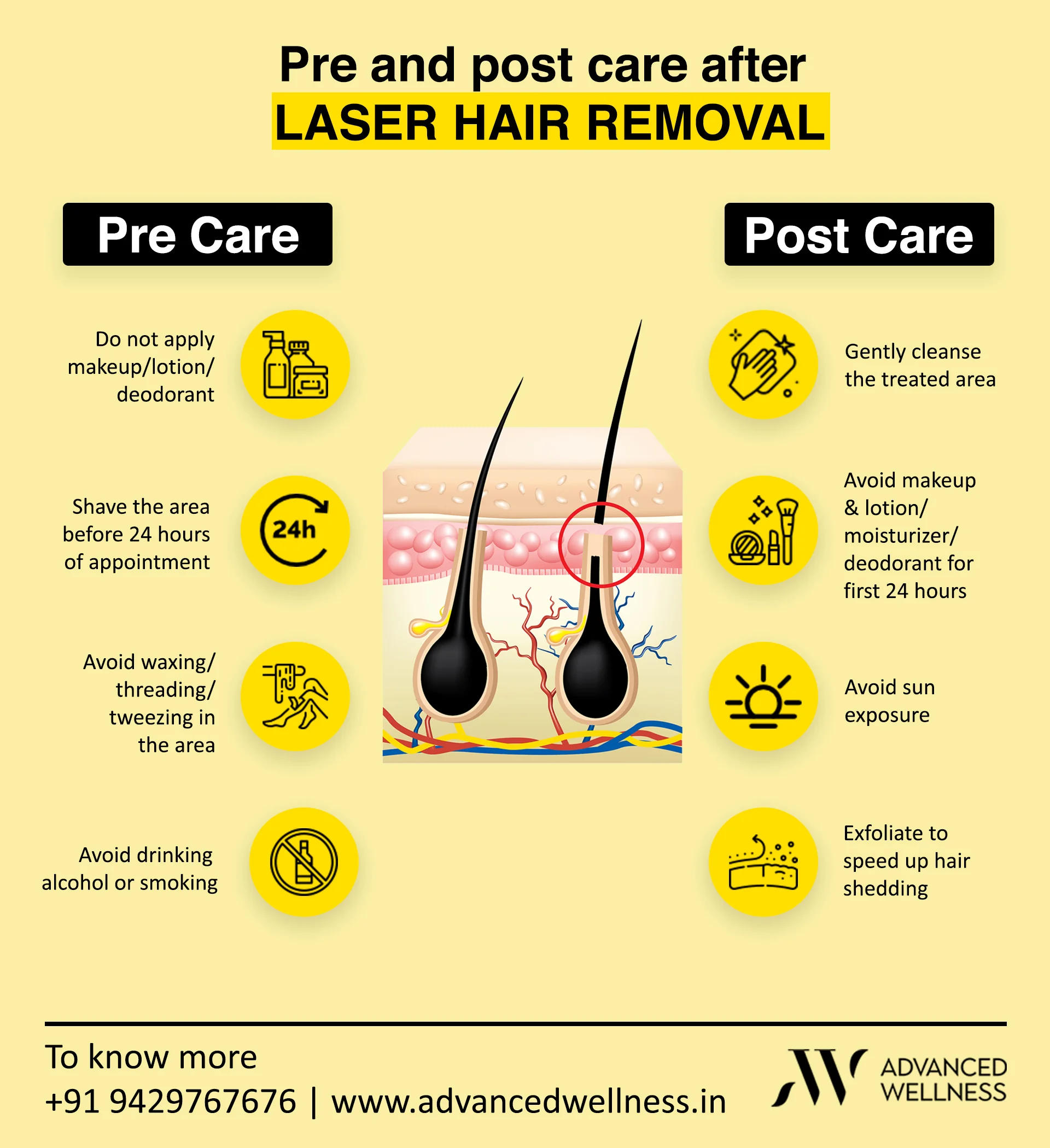 How long does hair laser removal last