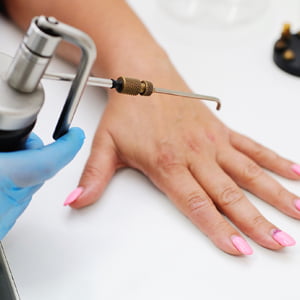 laser hair removal in Ghaziabad