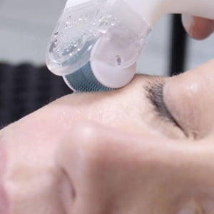 laser hair removal in gurgaon