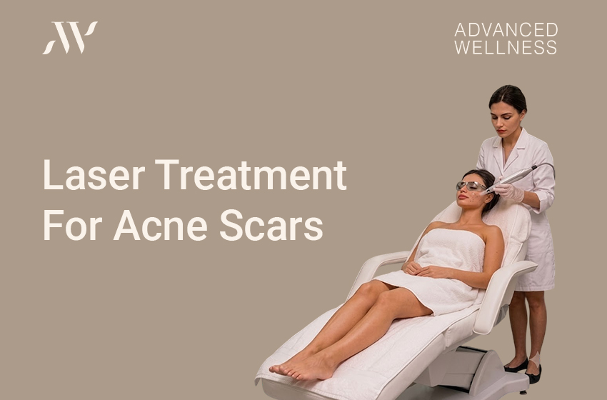 Laser Treatment For Acne Scars