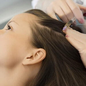 prp hair treatment in Gurgaon