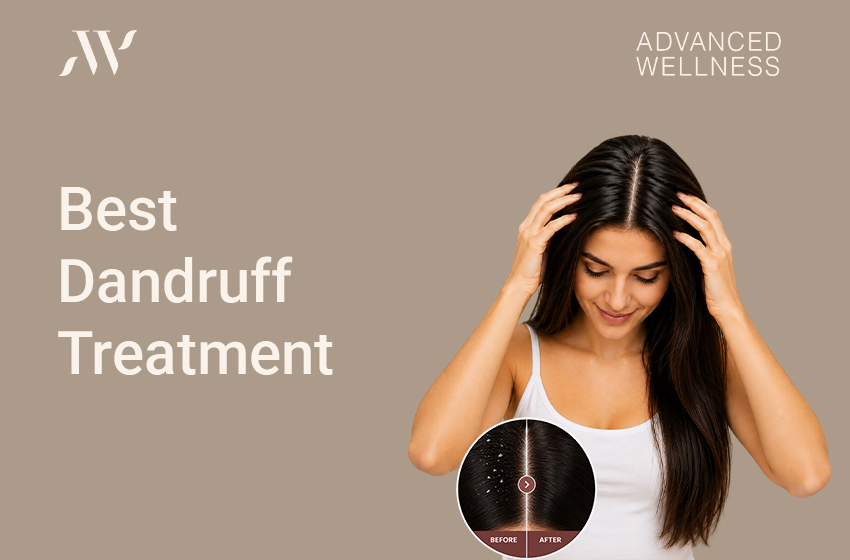 Best Dandruff Treatment