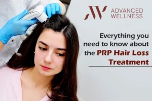Read more about the article Everything you need to know about the PRP Hair Loss Treatment