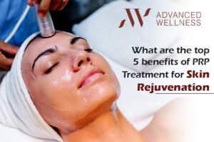 Read more about the article What are the top 5 benefits of PRP Treatment for Skin Rejuvenation?
