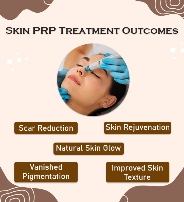 PRP Treatment For Skin Outcomes