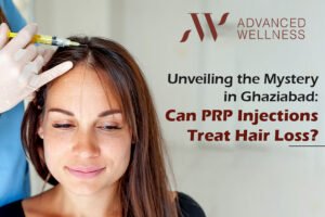 Read more about the article Unveiling the Mystery in Ghaziabad: Can PRP Injections Treat Hair Loss?