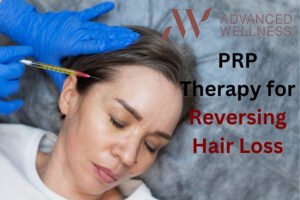 Read more about the article Bald No More: The Promise of PRP Therapy for Reversing Hair Loss in Delhi NCR