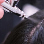 Dandruff-Treatment prp treatment in gurgaon