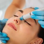 laser hair removal cost in Ghaziabad