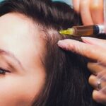 Best PRP Clinic for hair loss- Advanced wellness Best PRP Clinic for hair loss- Advanced wellness